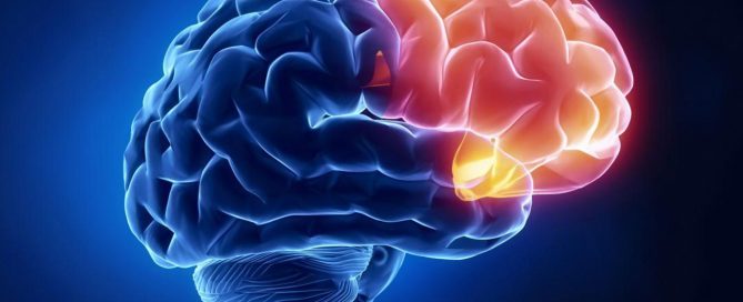 Cérebro, doenças neurológicas e covid-19 - Dr. Claudio Corrêa