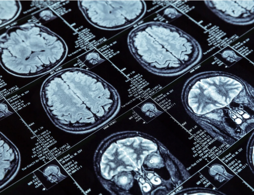 Desvendando tumores cerebrais: diferenças entre benignos e malignos